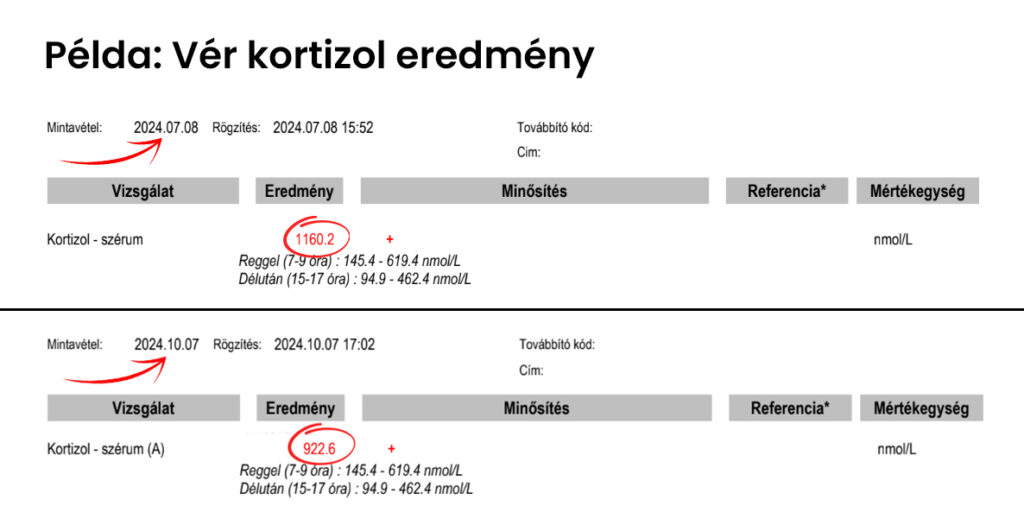 Kortizol szint mérése nyálból eredménye referencia tartományokkal együtt