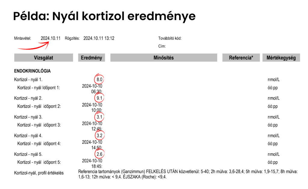 Kortizol szint mérése nyálból eredménye referencia tartományokkal együtt